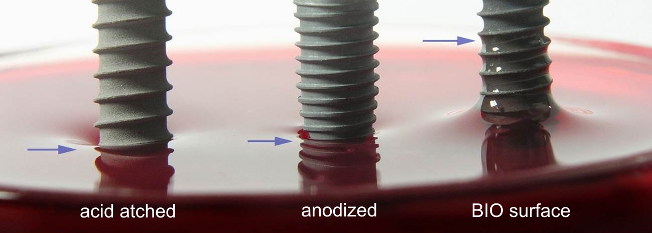 Wettability comparison of acid-etched, anodized and BIO surface titanium implants