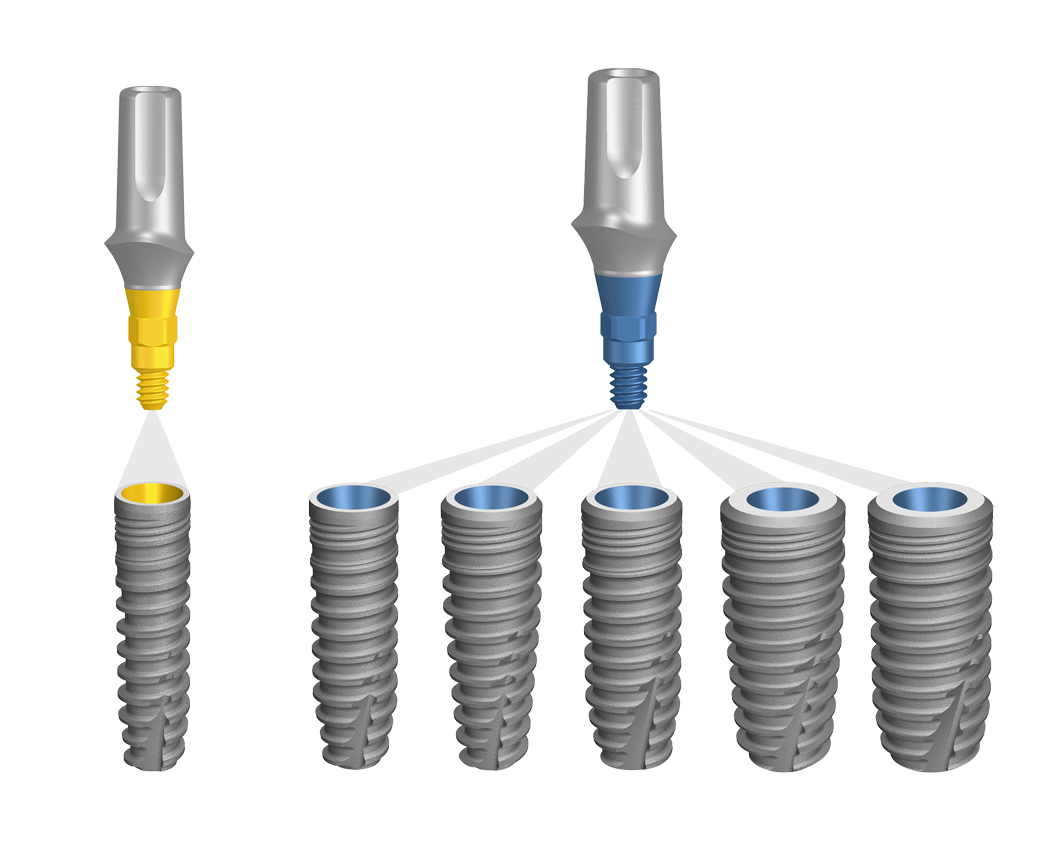 BioniQ prosthetic components for individualized restorations