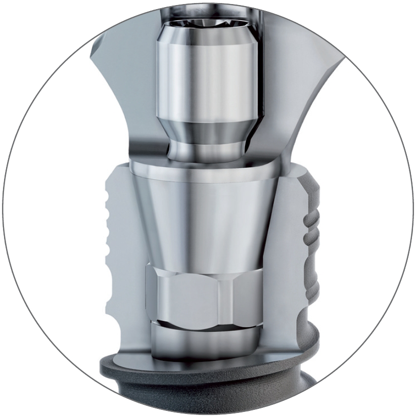 Cross-section of the BioniQ Q-Lock implant-abutment connection